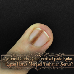 Muncul Garis Gelap Vertikal pada Kuku, Kapan Harus Menjadi Perhatian Serius?